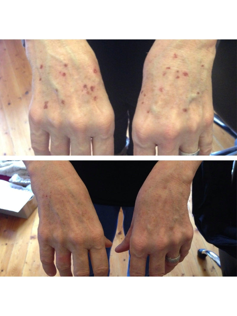 ADORN Pink Grapefruit Spot Treatment Serum