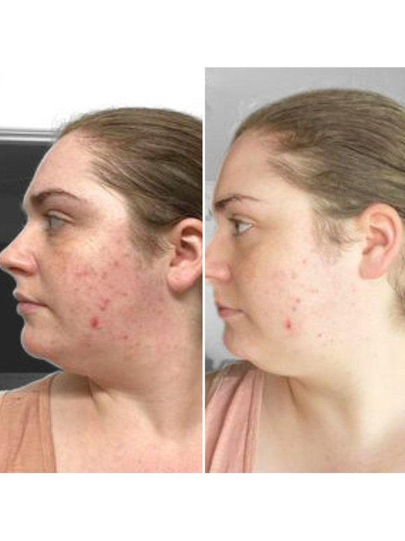 ADORN Pink Grapefruit Spot Treatment Serum